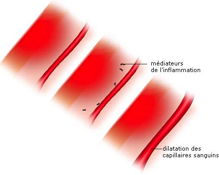 dilatation capillaires