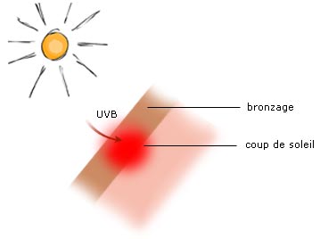 Effets des UV B