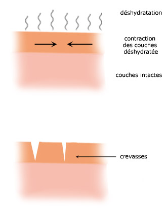La déshydratation provoque un tiraillement des couches superficielles de la peau, puis l'apparition de crevasses.