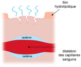 dilatation des capillaires sanguins