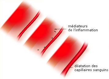 dilatation capillaires