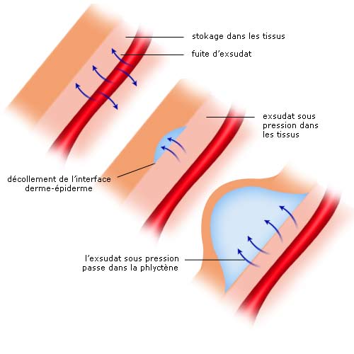 Production d'exsudat