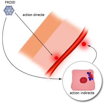 Principe de la brûlure par le froid