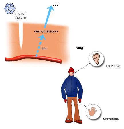 Symptomes crevasses