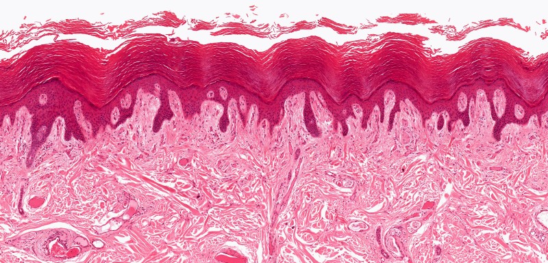 Des cellules cutanées capables de régénérer la peau