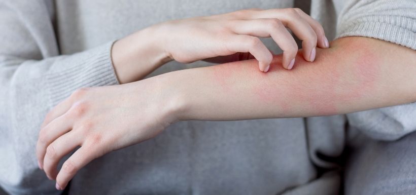 Berce du Caucase, elle peut entraîner des brûlures ! Berce du Caucase, elle peut entraîner des brûlures !